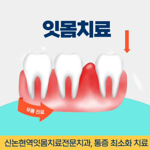 논산치과 논산시 치과 잇몸치료